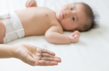Losing It: Understanding Postpartum Hair Loss and Why Women Experience It