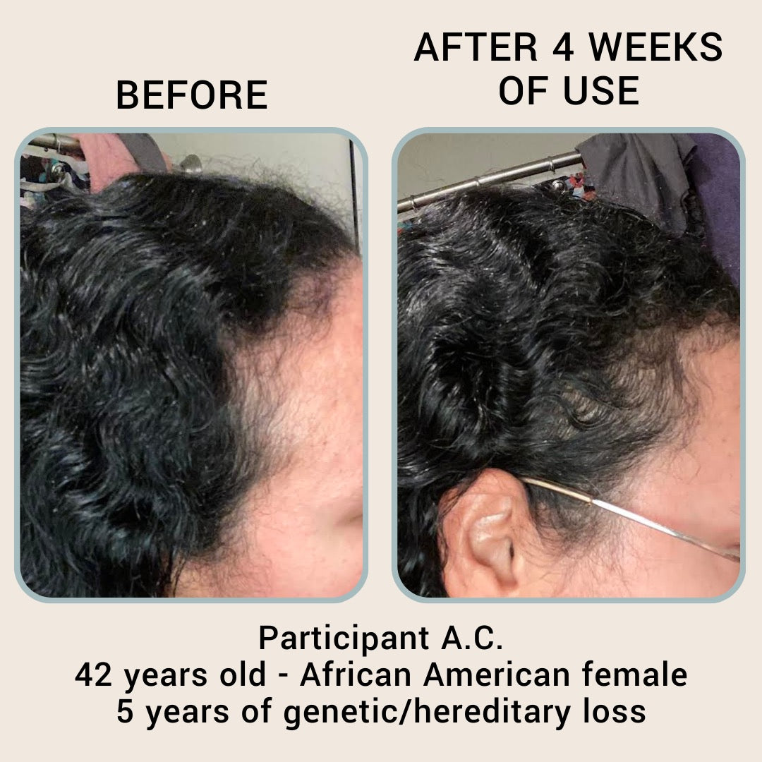 The Hair Revival Serum